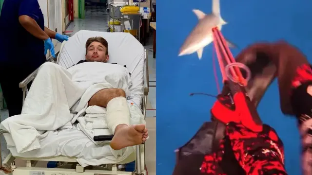 Influencer hospitalized after filming shark attack and nearly having leg bitten off