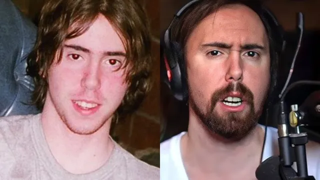 Asmongold reveals why he “looks like a rat” and urges viewers to brush their teeth