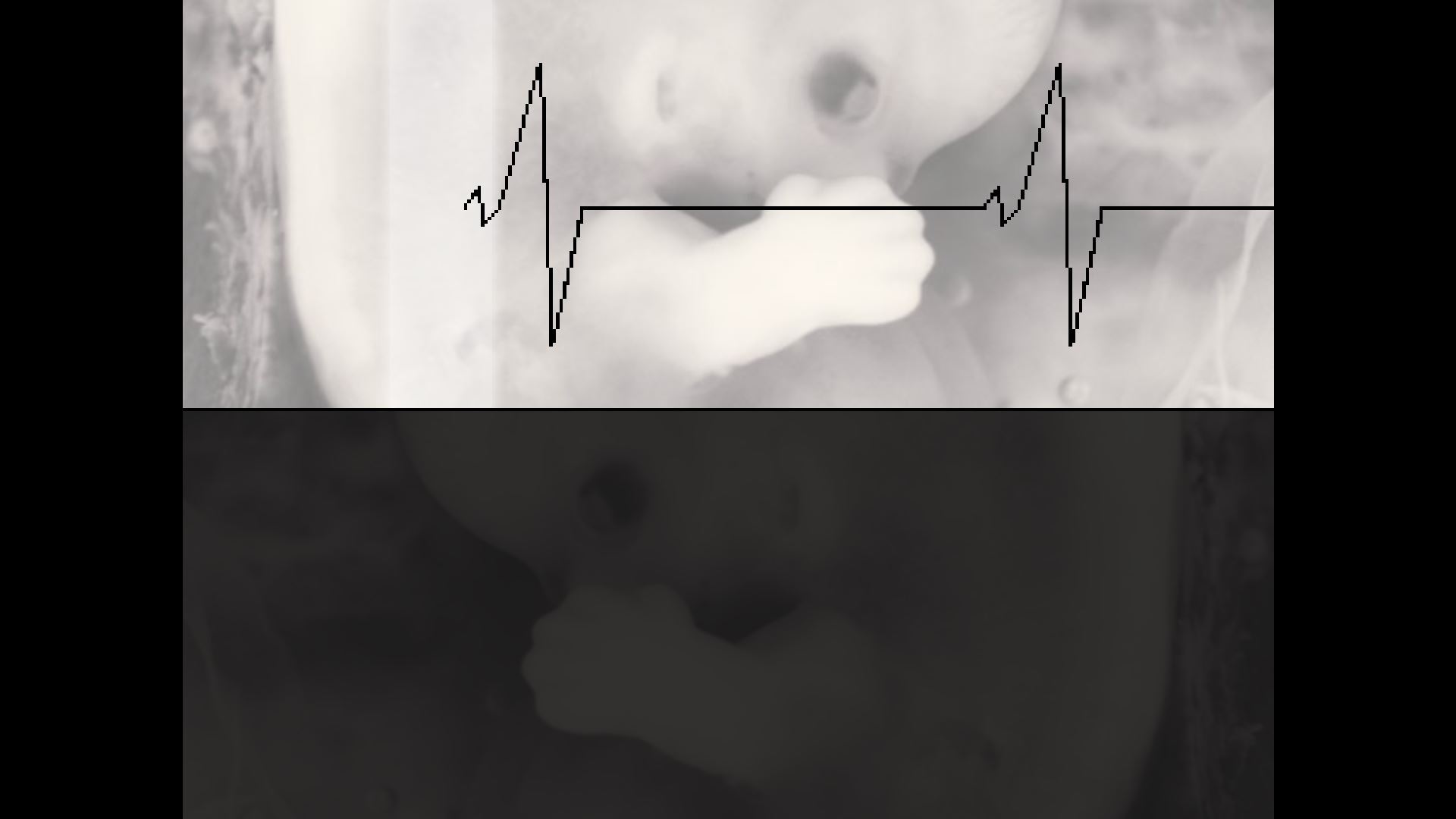 The Heart Attack cover art