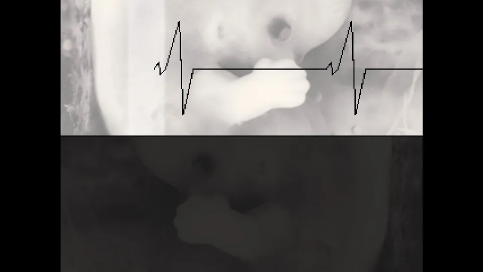 The Heart Attack cover art