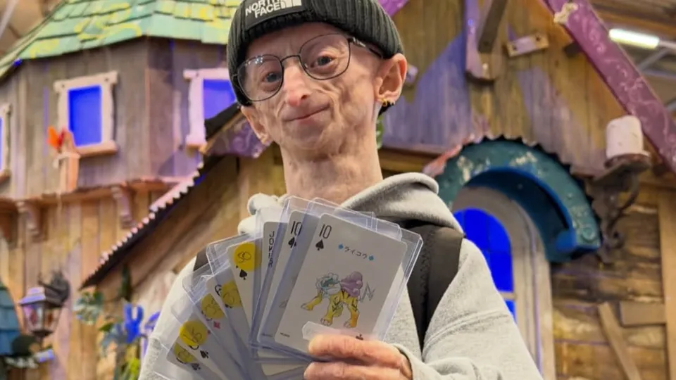 Influencer Michiel Vandeweert dies at 28 after documenting rare rapid aging disorder
